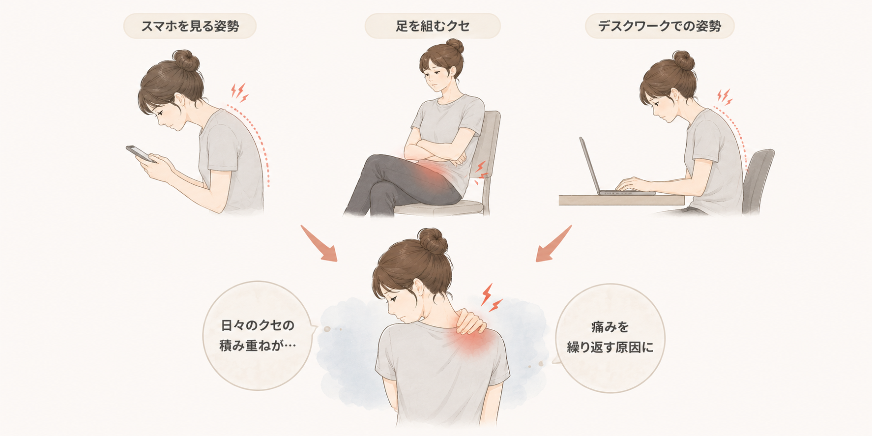 姿勢・動きのクセが痛みを繰り返す図解